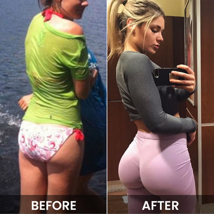 LIMETOW™ Butt Enhancement Cream